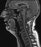 MRI - Copyright - Stefanie Rummel